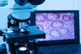 Photograph of a microscope with a computer screen in the background showing an image of purple cells